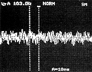 データ(加速度検出器からの時間軸信号）